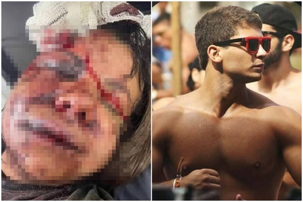 Caso de mulher agredida no elevador: como saber quando a relação é uma ameaça?